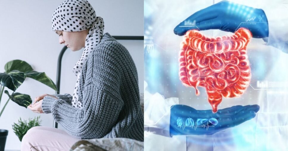 Ilustração câncer e problemas no intestino (Fotos: Canva / Freepik)