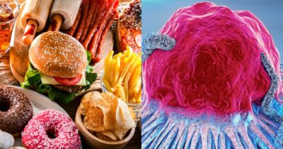 10 alimentos populares que aumentam o risco de câncer aos 50+ - Foto: Montagem