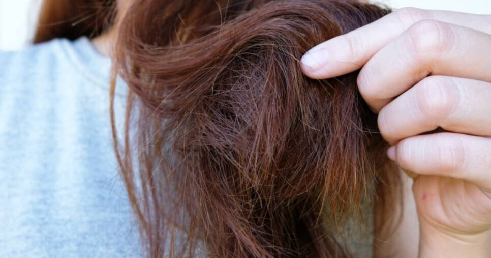 Essas 5 atitudes destroem o seu cabelo e precisam ser evitadas (Foto: Divulgação)