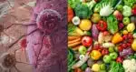 4 alimentos naturais que ajudam a prevenir o câncer - Foto: Montagem