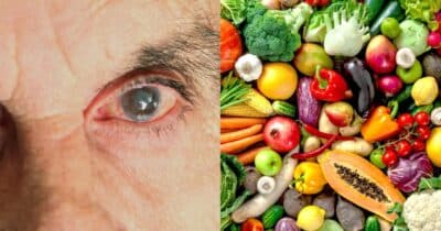 Especialista revela 6 alimentos para manter a saúde dos olhos - Foto: Montagem