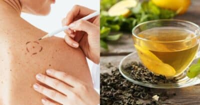 Esses são os 2 melhores chás para prevenir o câncer de pele - Foto: Montagem