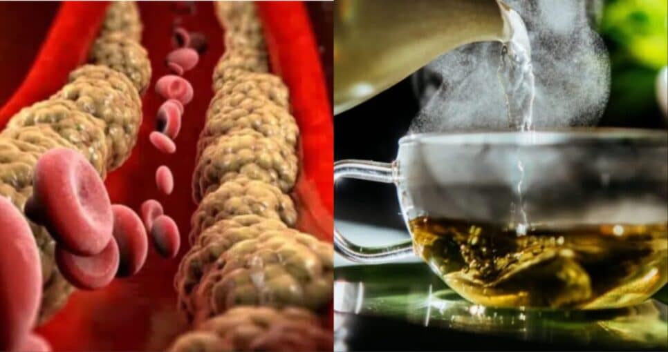 Nutricionista revela o melhor chá para ajudar a controlar o colesterol alto - Foto: Montagem