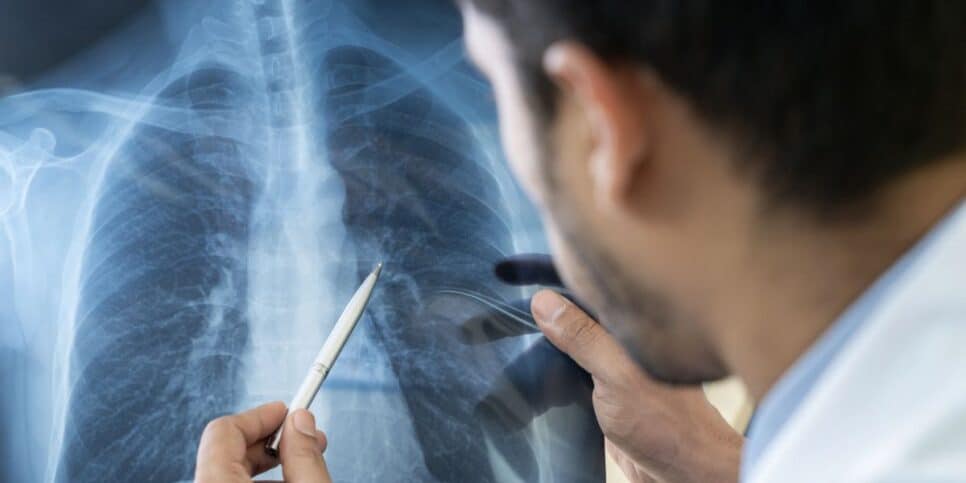 Tome cuidado com a pneumonia silenciosa (Reprodução: Internet)