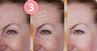 3 ingredientes põe fim nas rugas (Foto: Reprodução / Canva / Montagem TV Foco)