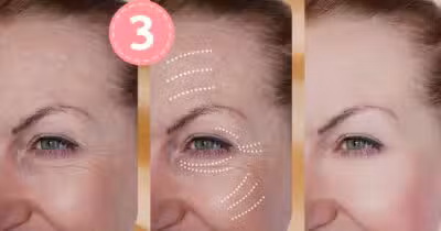 3 ingredientes põe fim nas rugas (Foto: Reprodução / Canva / Montagem TV Foco)