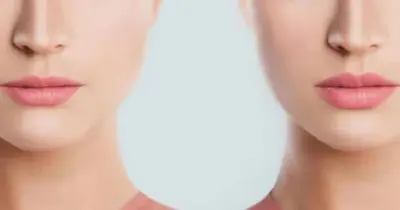 Preenchimento natural: Truque traz lábios volumosos e boca impecável instantaneamente