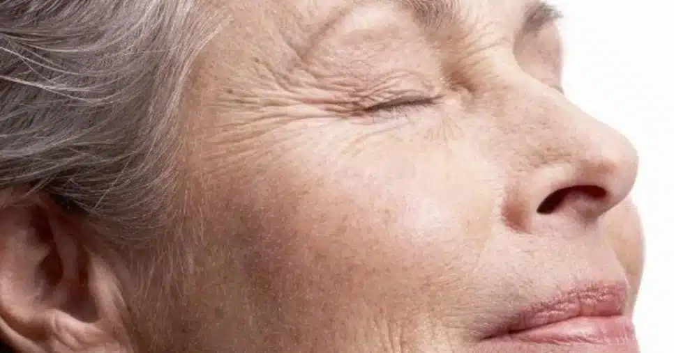 Creme caseiro para atenuar as rugas e manchas da pele (Foto: Reprodução/ Internet)