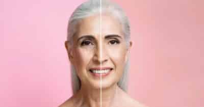 Ilustração antes e depois de rugas (Foto: Freepik)