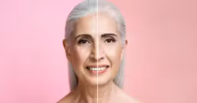 Ilustração antes e depois de rugas (Foto: Freepik)