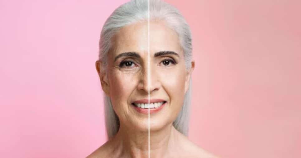 Ilustração antes e depois de rugas (Foto: Freepik)