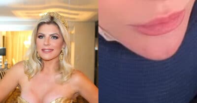 Lembra? Íris Stefanelli ressurge com procedimento e irreconhecível (Foto: Reprodução/Montagem TV Foco)