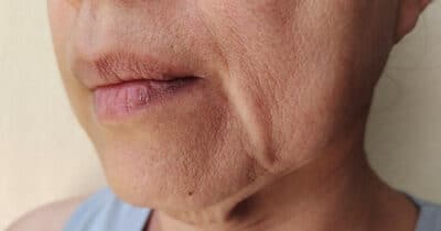 Esses são os hábitos que te rejuvenescem e te faz evitar as rugas (Foto: Divulgação)