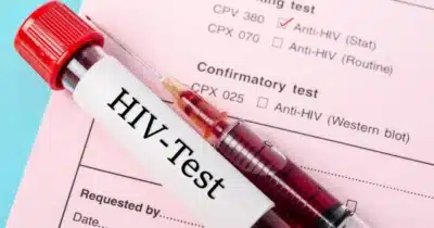 Sintomas iniciais do HIV revelados e você precisa saber para agir (Foto: Reprodução/ Internet)