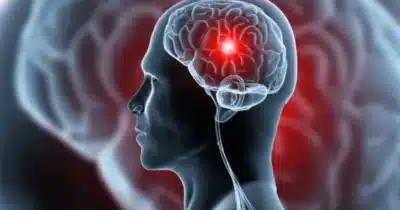 Tontura, dor de cabeça e mais: 5 sinais que antecedem um AVC (Foto: Reprodução/ Internet)