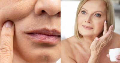 Tratamento natural acaba com bigode chinês - Foto Reprodução Internet