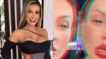 Andressa Urach desfigura o rosto e pede orações: "Arrependida" (Foto: Reprodução/Montagem TV Foco)