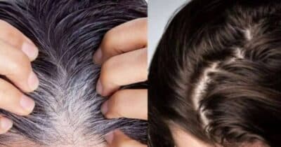 Óleo natural cobre os fios brancos até a raiz do cabelo - Foto; Montagem
