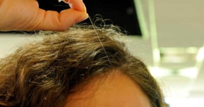 Os fios de cabelo branco vão chegar ao fim (Foto: Divulgação)