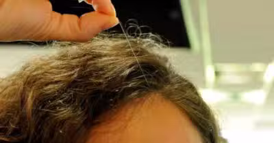 Os fios de cabelo branco vão chegar ao fim (Foto: Divulgação)