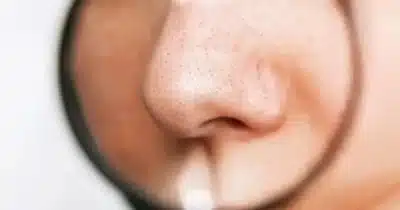 Adeus cravos (Foto: Reprodução/ Internet)