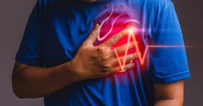 Os sinas de que você terá um infarto (Foto: Divulgação)