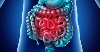 Intestino funcionando melhor que laxante (Foto: Divulgação)