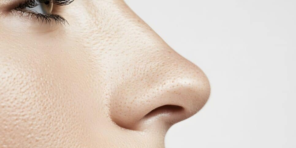 Nariz, Rinoplastia