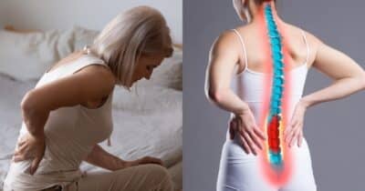 Entenda relação entre osteoporose e câncer (Foto: Divulgação)