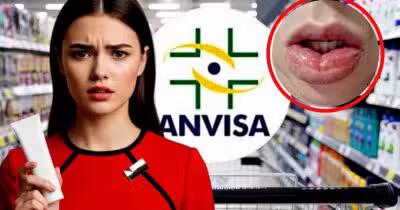 Retirada de creme dental popular é informado pela ANVISA após irritações graves (Foto Reprodução/Montagem/Lennita/Tv Foco/Canva/Lennita)