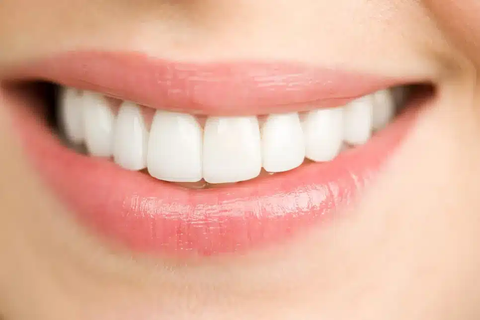 Dentes perfeitamente alinhados (Foto: Reprodução/ Internet)