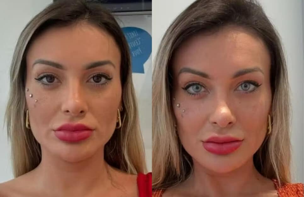 Andressa Urach fala sobe procedimento arriscado (Foto: Reprodução/Montagem)