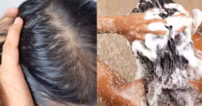 3 shampoos para controlar a oleosidade - Montagem: TVFOCO