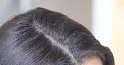 Os fios de cabelo branco (Foto: Divulgação)