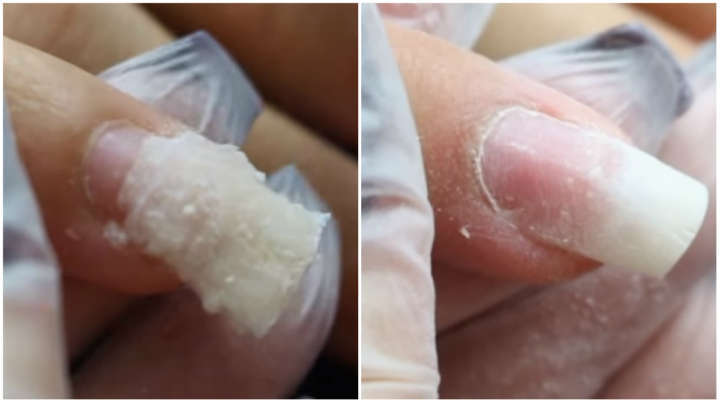 Tudo sobre o truque para colar sua unha quebrada sem precisar fazer uso de gel - Foto Internet