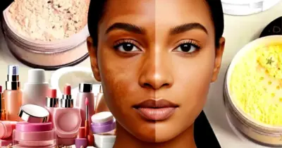 Como fazer sérum facial caseiro com 2 ingredientes para acabar com o melasma e hidratar a pele