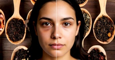 Veja como eliminar manchas fazendo uso de chá (Foto Reprodução/Montagem/Lennita/Tv Foco/Canva/GMN)