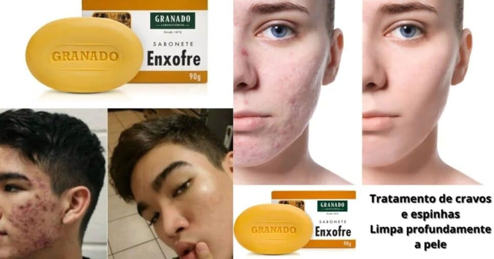 Sabonete de Enxofre Granado (Foto Reprodução/Montagem/Internet/Tv Foco/Lennita)