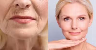 Mulher com rugas e mulher com a pele madura saudável (Foto: Reprodução/ Internet)