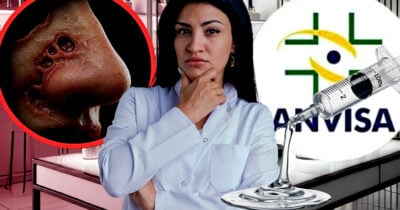 ANVISA proíbe marca de Botox após denúncia de risco real (Foto Reprodução/Montagem/Lennita/Tv Foco/GMN/Freepik)