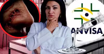 ANVISA proíbe marca de Botox após denúncia de risco real (Foto Reprodução/Montagem/Lennita/Tv Foco/GMN/Freepik)