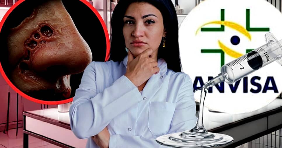 ANVISA proíbe marca de Botox após denúncia de risco real (Foto Reprodução/Montagem/Lennita/Tv Foco/GMN/Freepik)