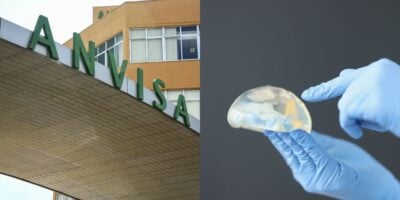 Anvisa suspense prótese mamária e do bumbum (Reprodução: Montagem TV Foco)