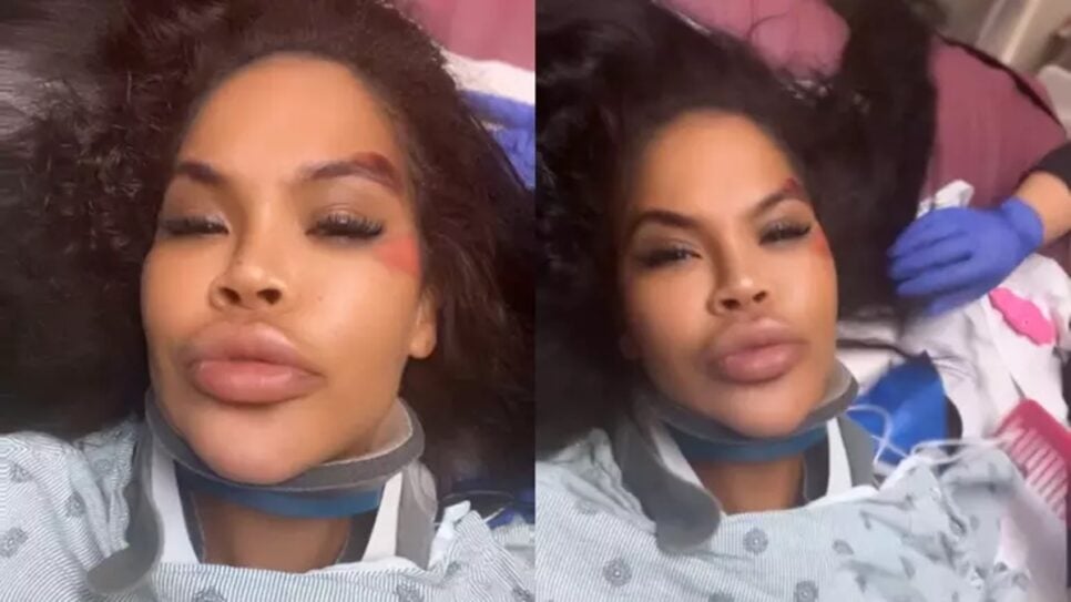 Ex-sister britânica expõe estado do carro e ferimentos em vídeo no hospital (Foto: Reprodução/ Instagram/ Montagem)