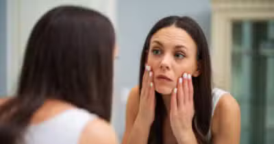 Veja como suavizar as olheiras sem maquiagem (Foto: iStock)