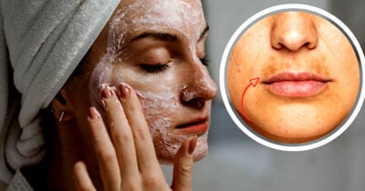 Máscara caseira elimina manchas sem necessidade de fazer um peeling químico (Foto Reprodução/Montagem/Lennita/Canva/ GMN/TV Foco)
