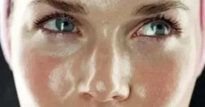 3 produtos populares, incluindo n°1 da Nivea, que você deve banir se tiver pele oleosa