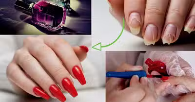 Ilustração de unhas antes e depois (Foto Reprodução/Montagem/Lennita/Tv Foco/Canva)