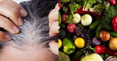 Cabelo branco e alimentos (Foto: Reprodução/ Internet)