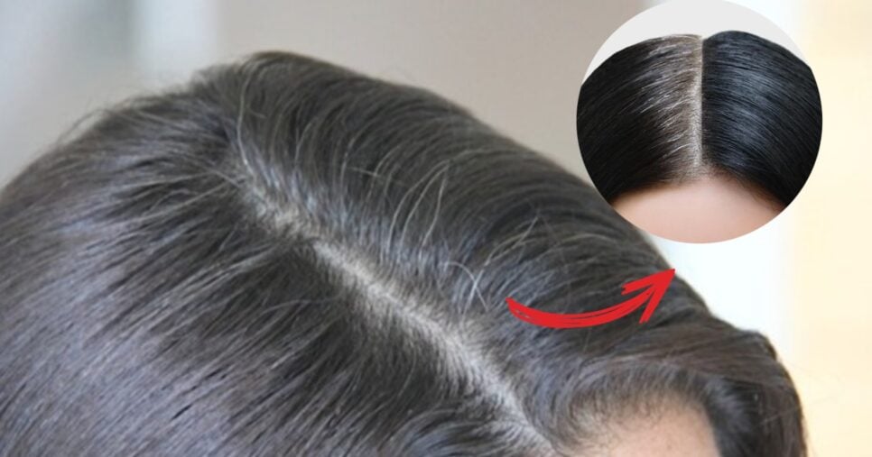 Cabelo branco e cabelo branco antes e depois (Foto: Reprodução/ Internet)